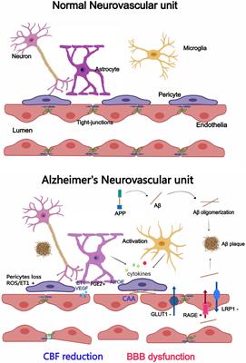 Cooperation between neurovascular dysfunction and Aβ in Alzheimer’s disease